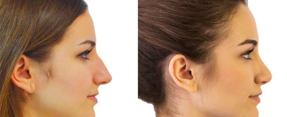 Clinic Results Gallery